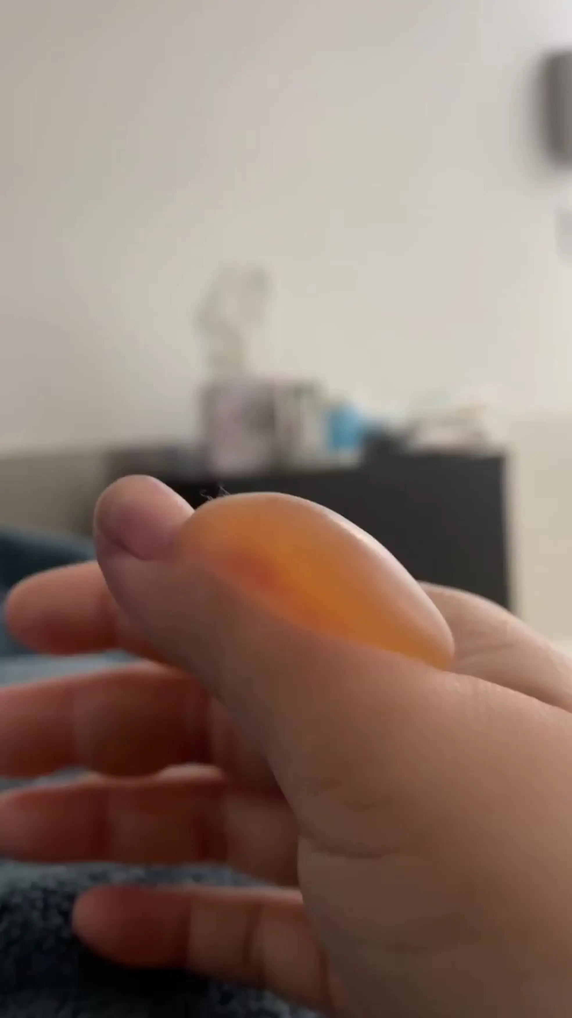 Parts of her hands and fingers had to be amputated.