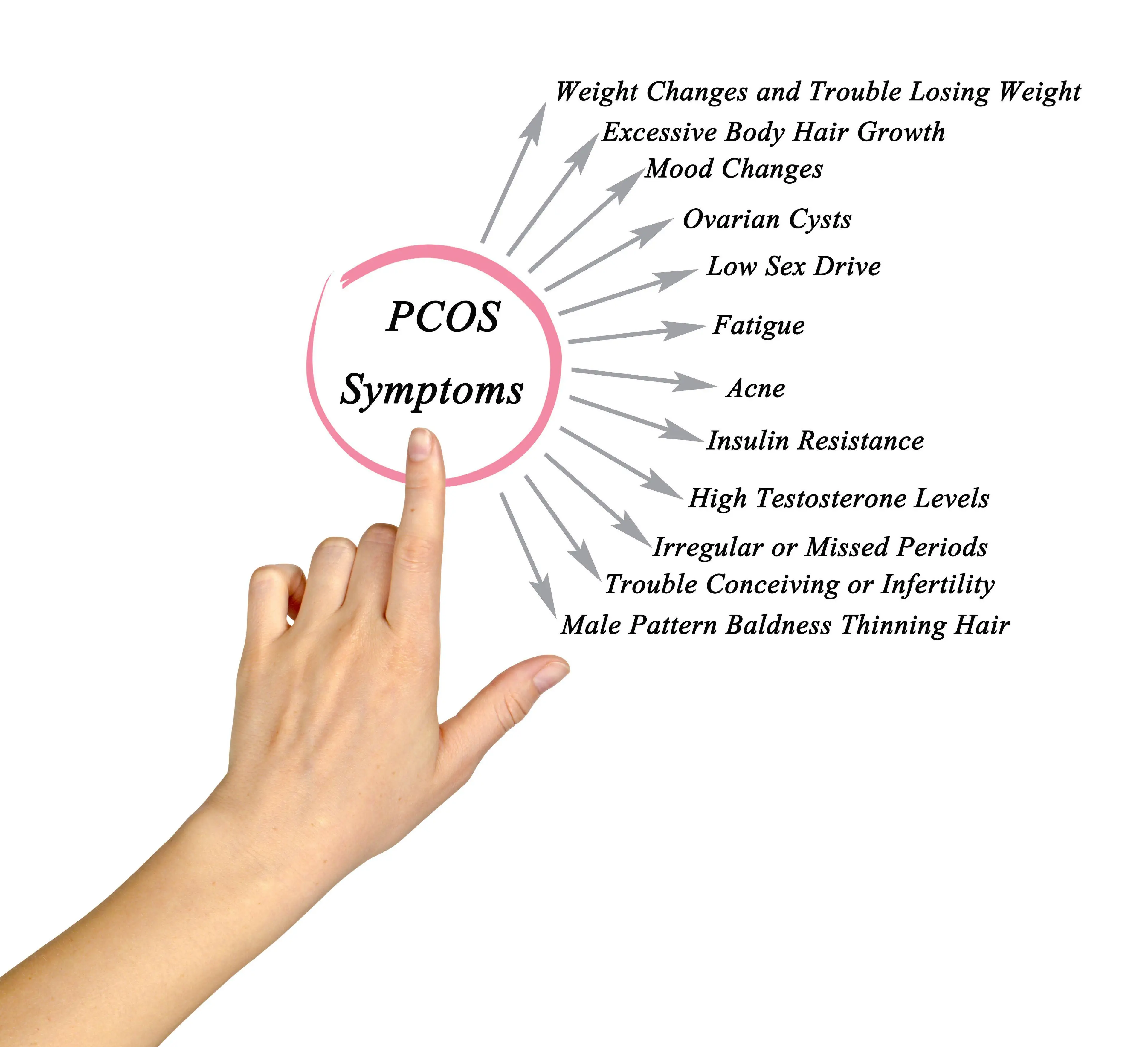 The symptoms of polycystic ovary syndrome can be incredibly varied, meaning it can be difficult to pinpoint.