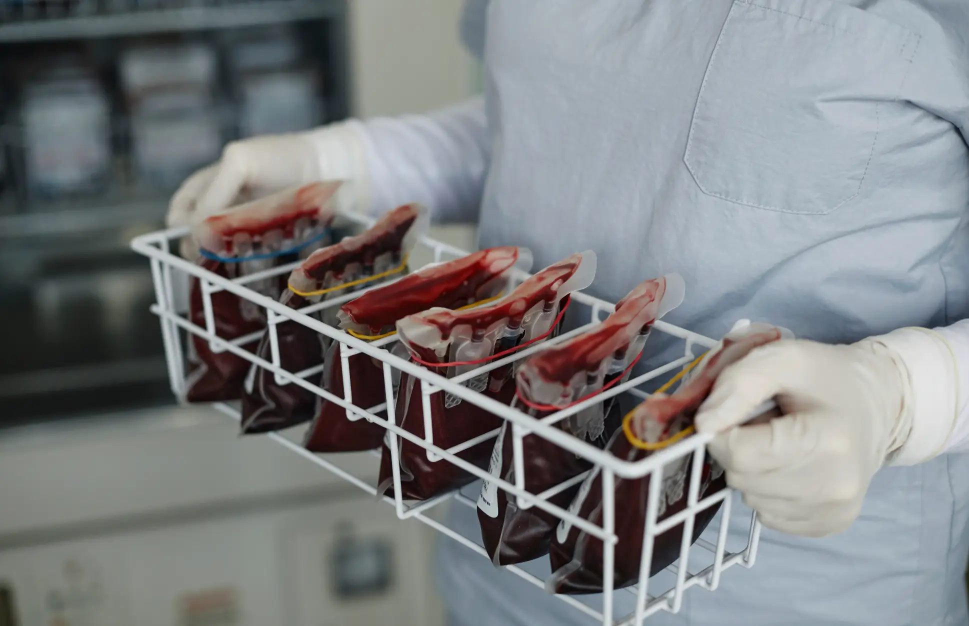 It was ruled that type A blood group members were 16 per cent more likely to suffer a stroke (Getty Stock Images)