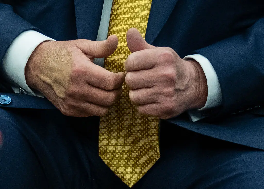 The White House previously attributed Trump's hand bruise to serial handshaking (ANDREW CABALLERO-REYNOLDS / Contributor / Getty Images)
