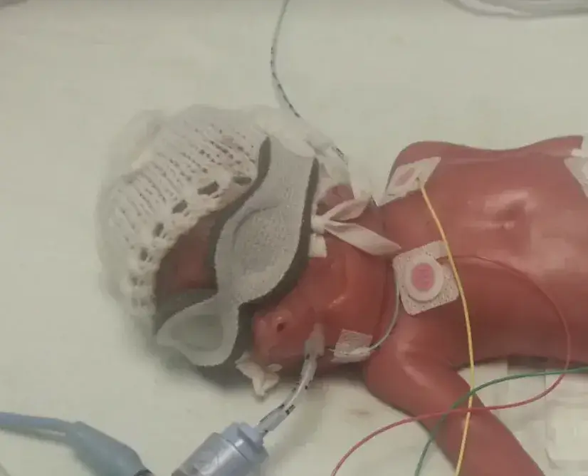 Asha managed to delay the progression of her labour.