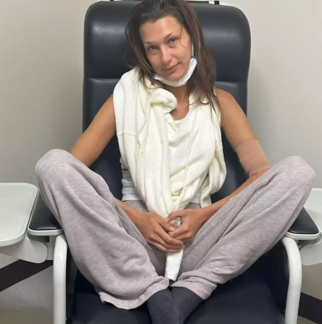 Bella Hadid is among those who have been diagnosed previously (Instagram/@bellahadid)