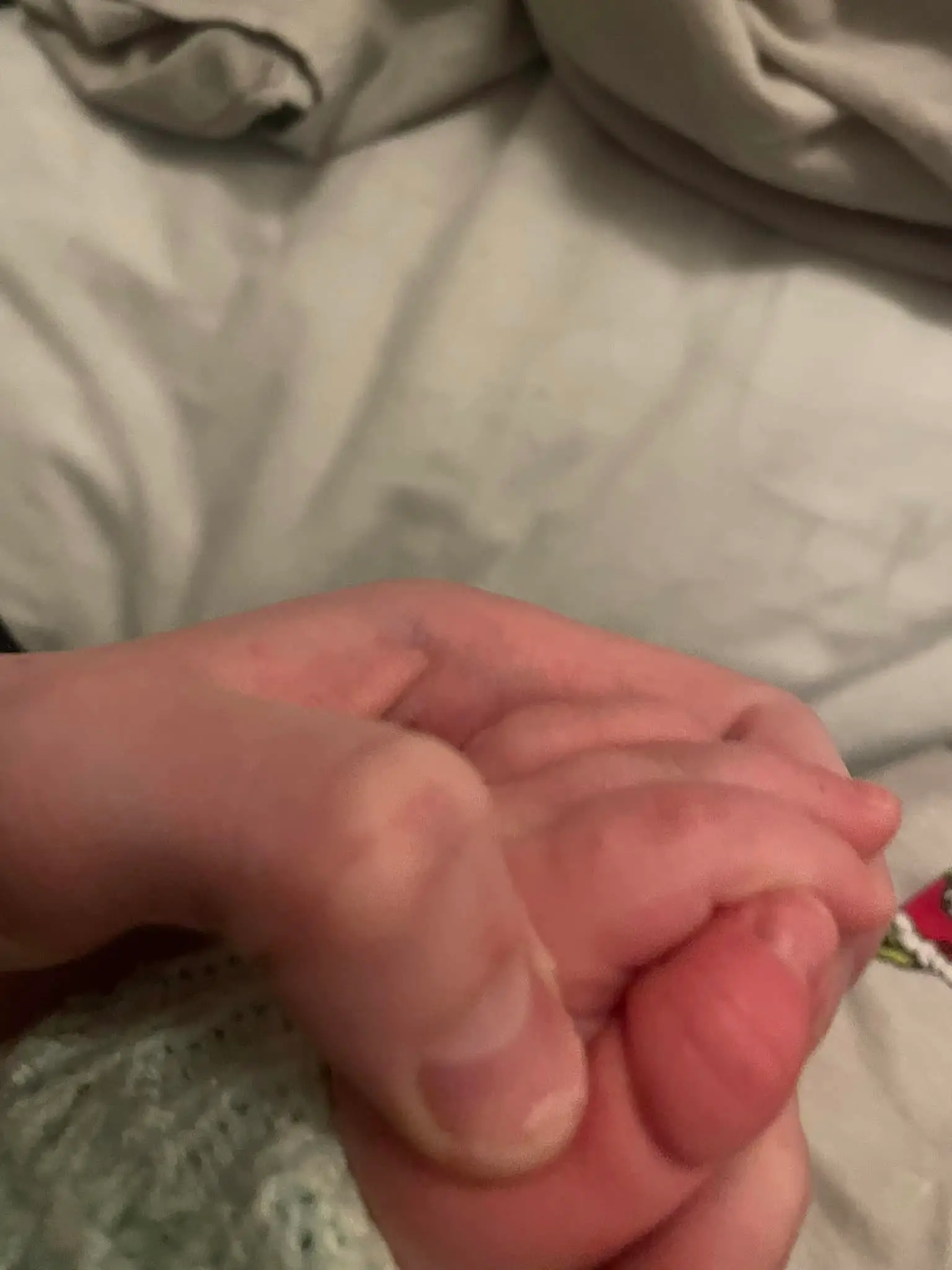 The thumb was visibly marked with the picture the mum posted to Facebook.