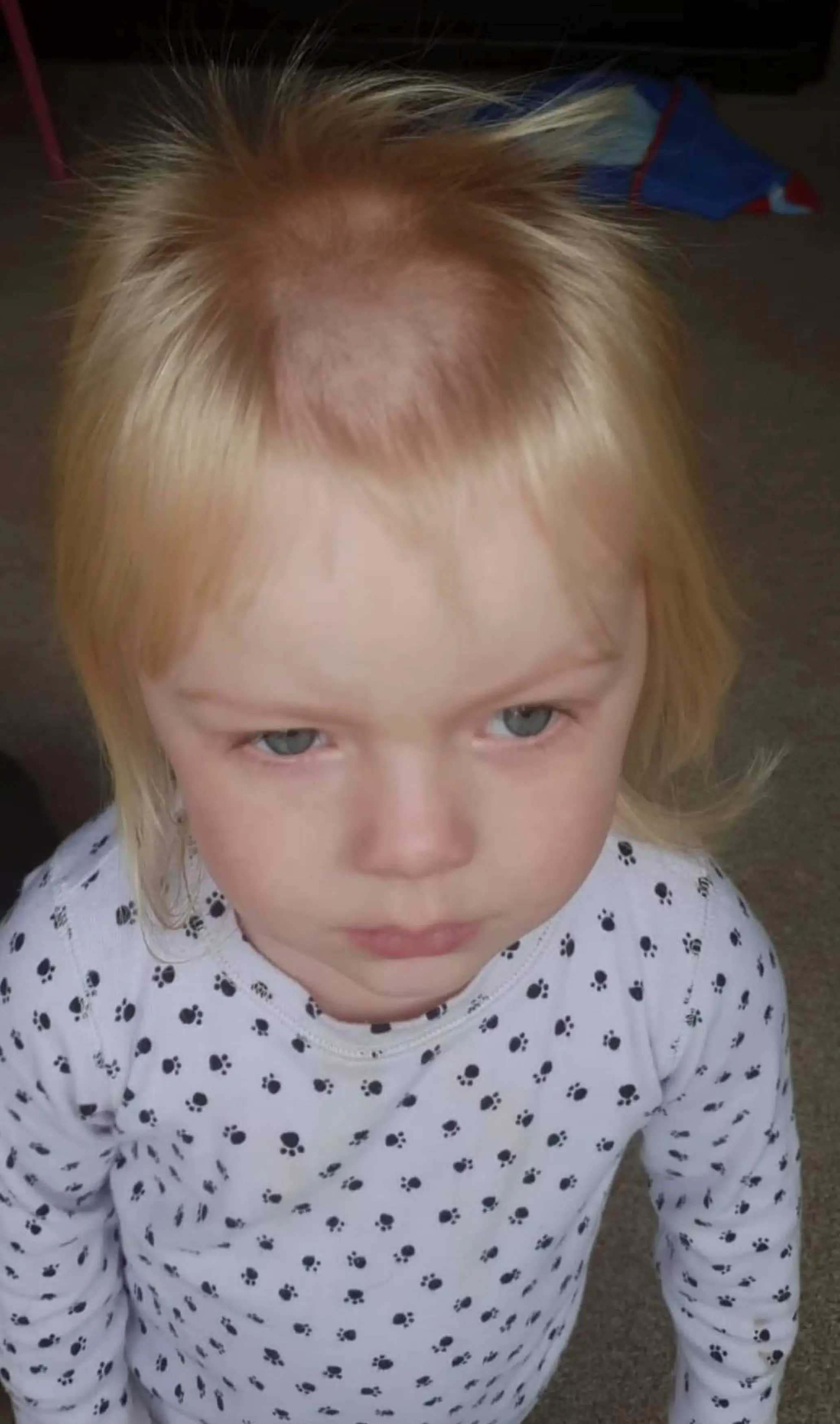 The toddler immediately after the hair mishap (
