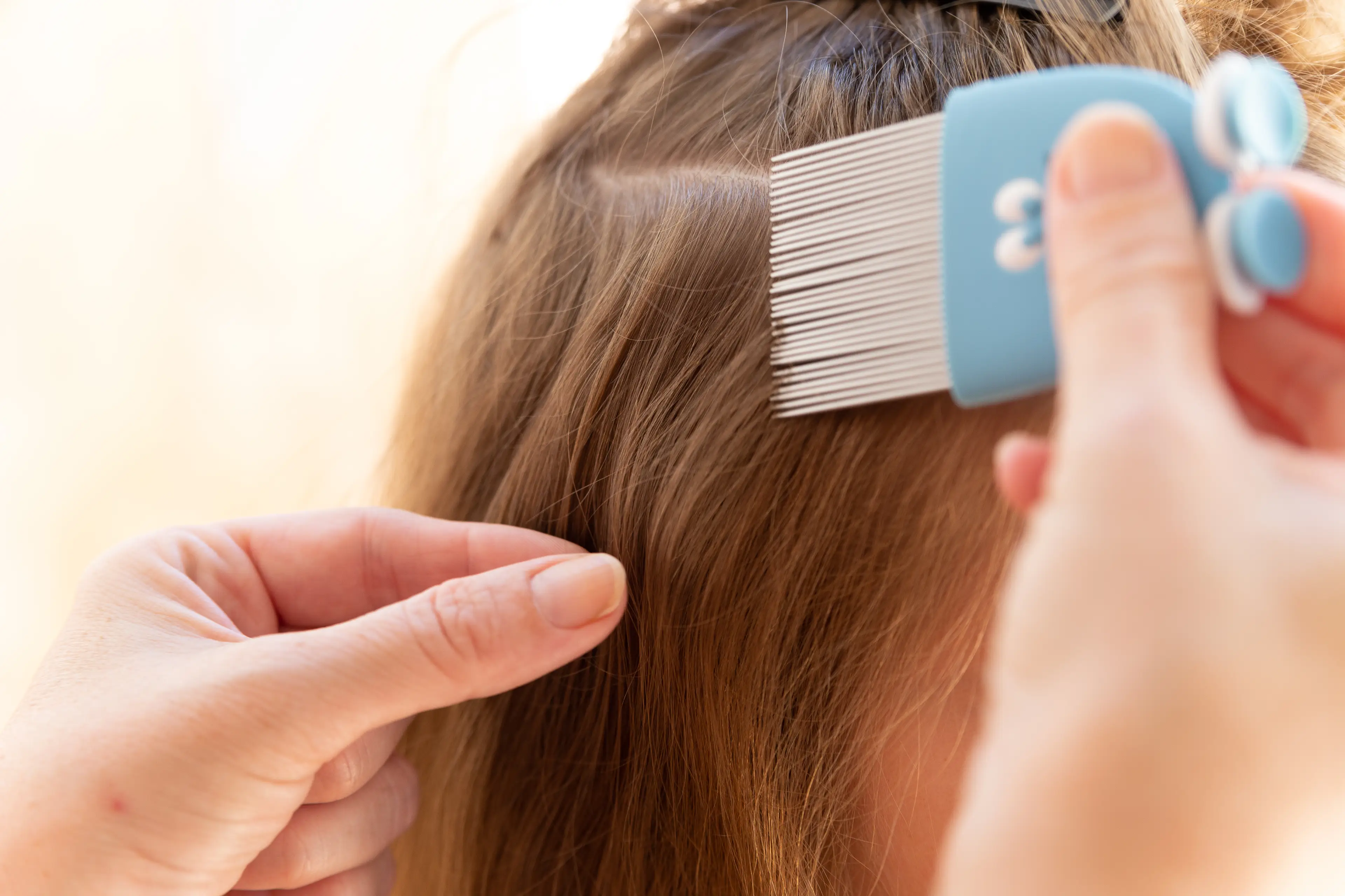 One Reddit user suggested head lice medication (Getty Stock Images)