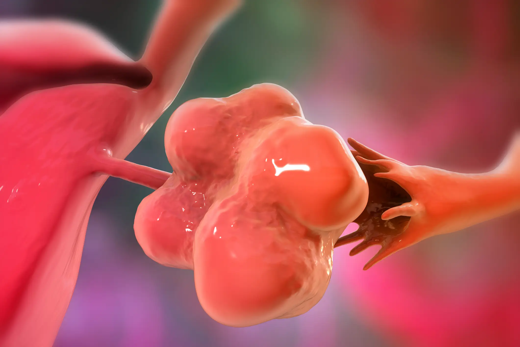 The NHS also lists oily skin or acne as a symptom of PCOS (KATERYNA KON/SCIENCE PHOTO LIBRARY / Getty Images)