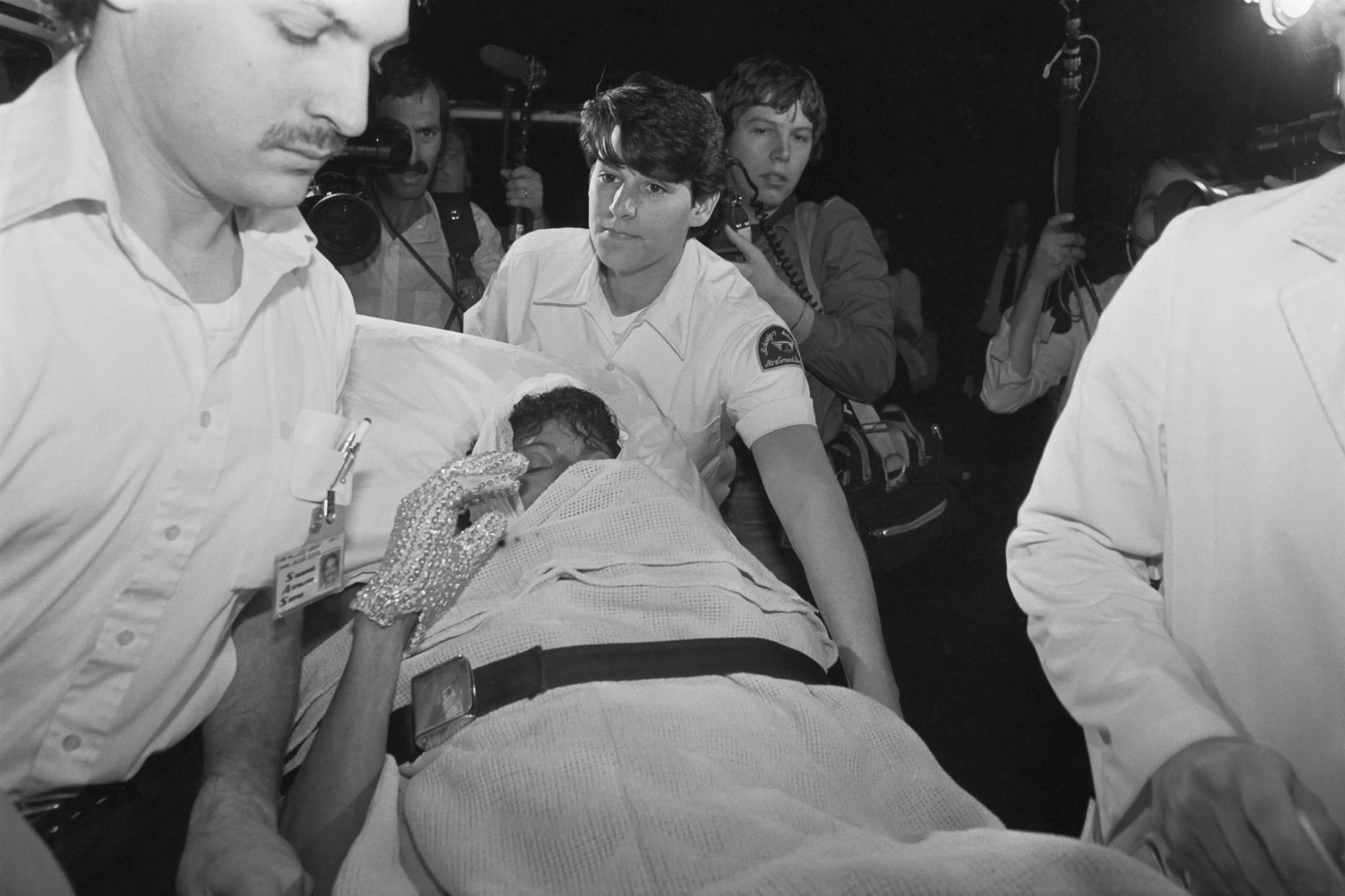 The singer suffered both second and third degree burns (Bettmann / Contributor)