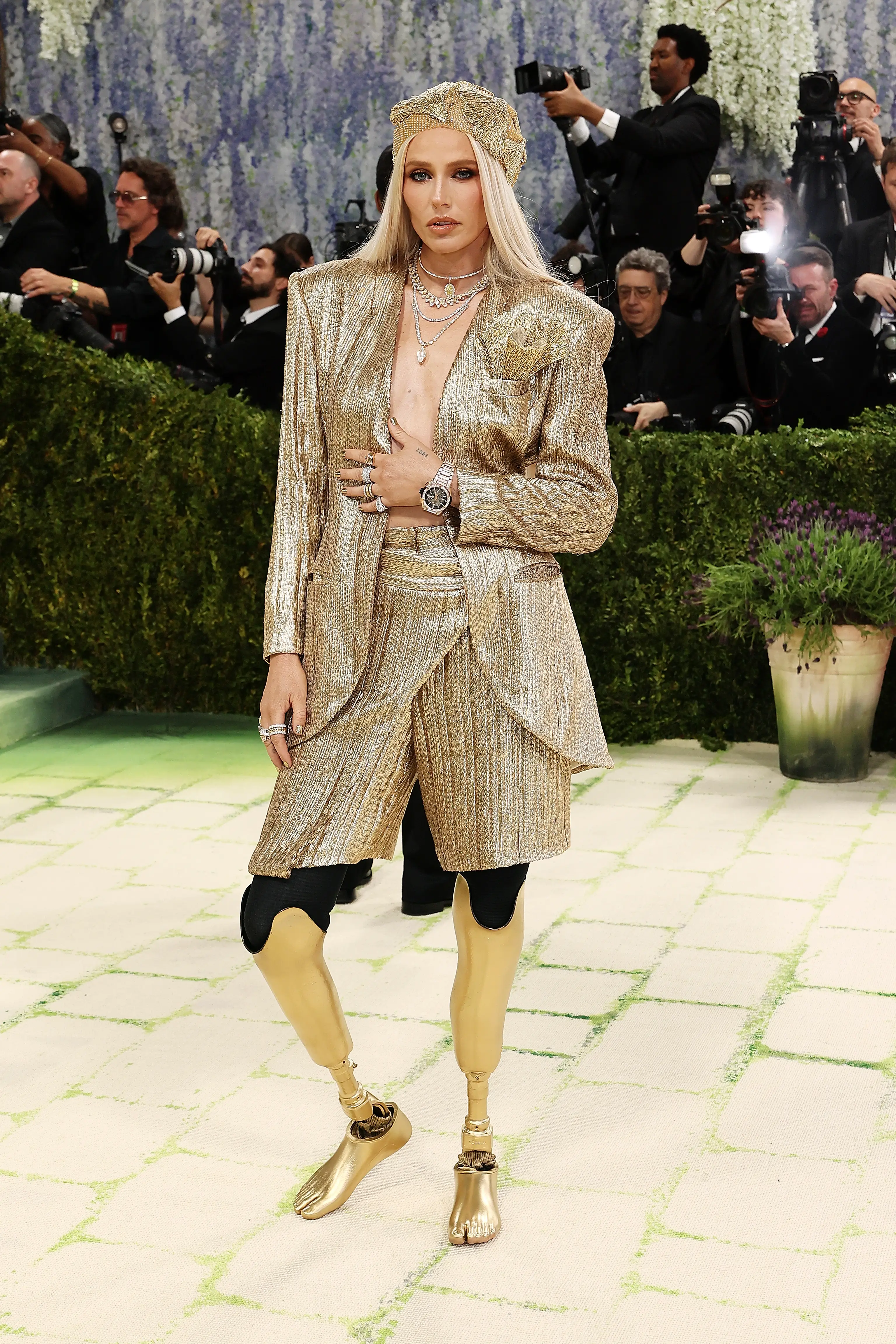 Lauren Wasser is known in the fashion world as the 'girl with the golden legs' (Mike Coppola/Getty Images)