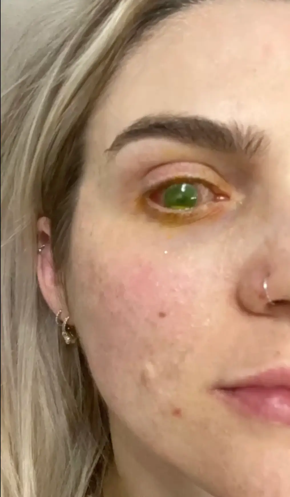 She had taken ibuprofen for menstrual cramps. (Jam Press/@‌jaque_gmack)