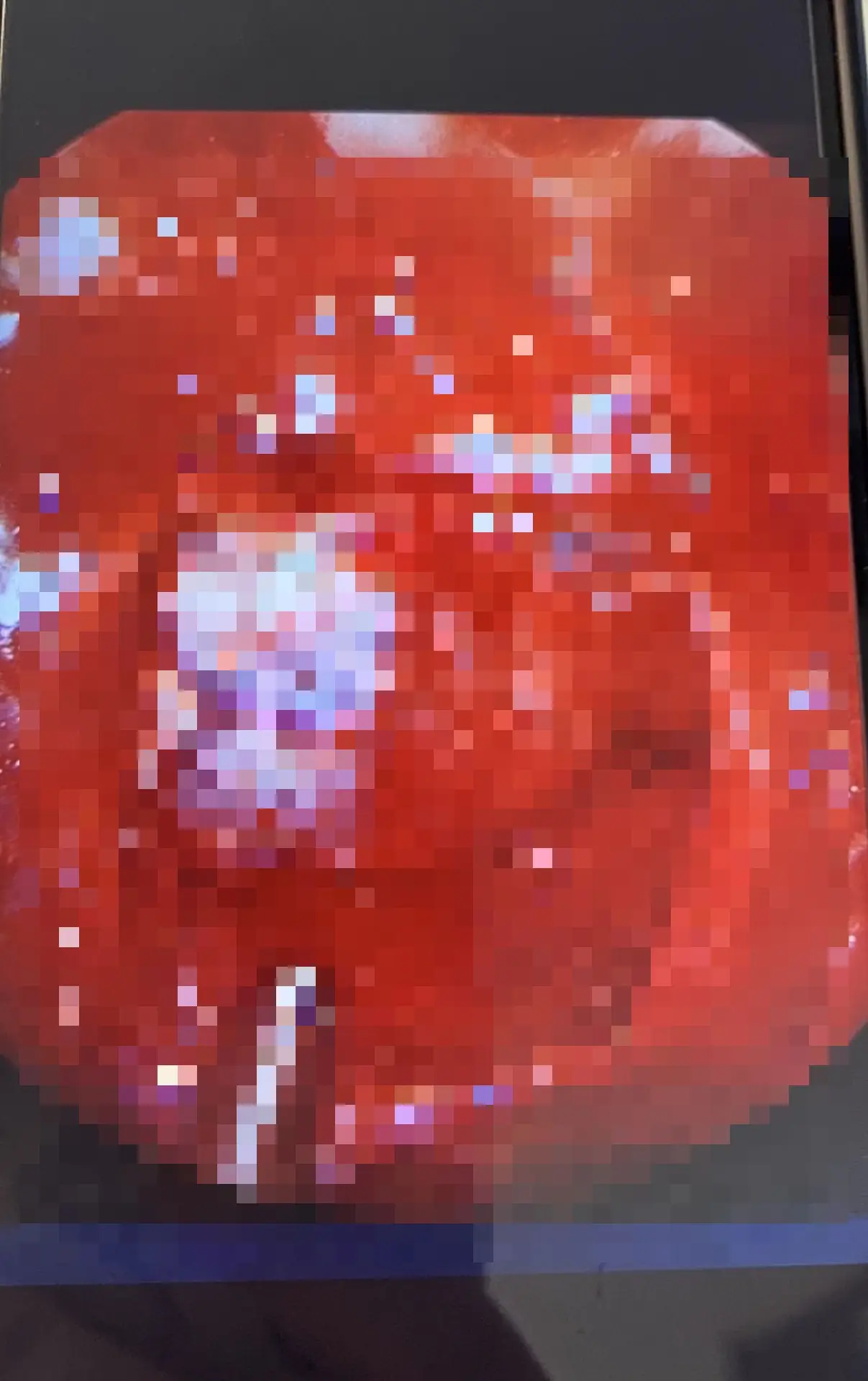 Luckily, the tumour was benign (Kennedy News and Media)