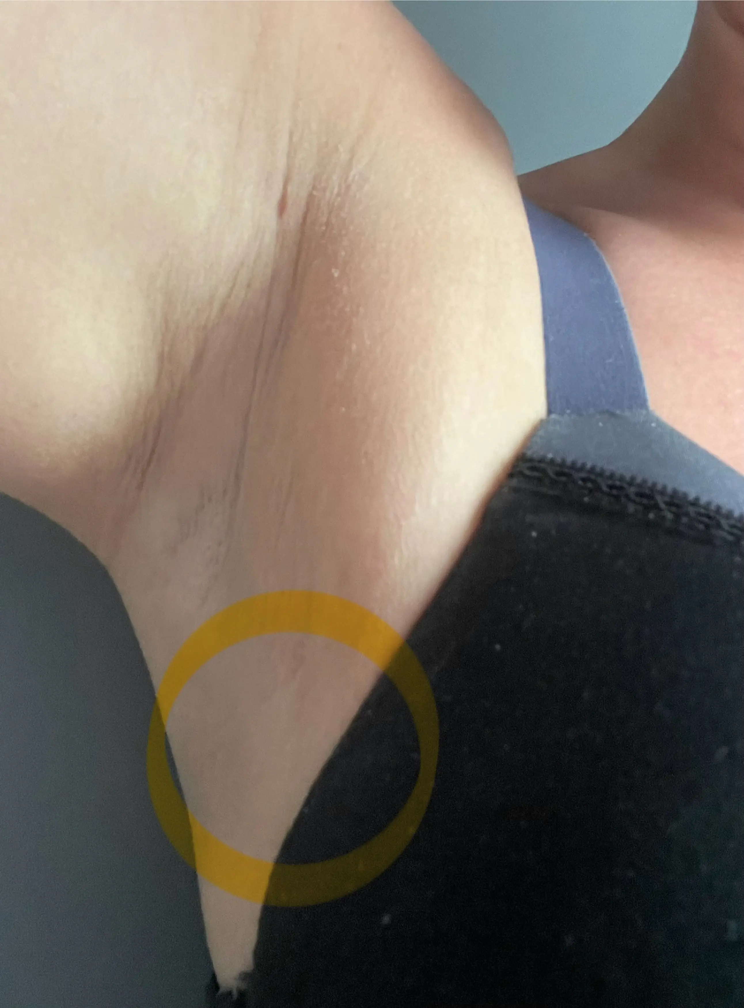 Kelly discovered the lump on her armpit in March. (Kennedy News and Media)