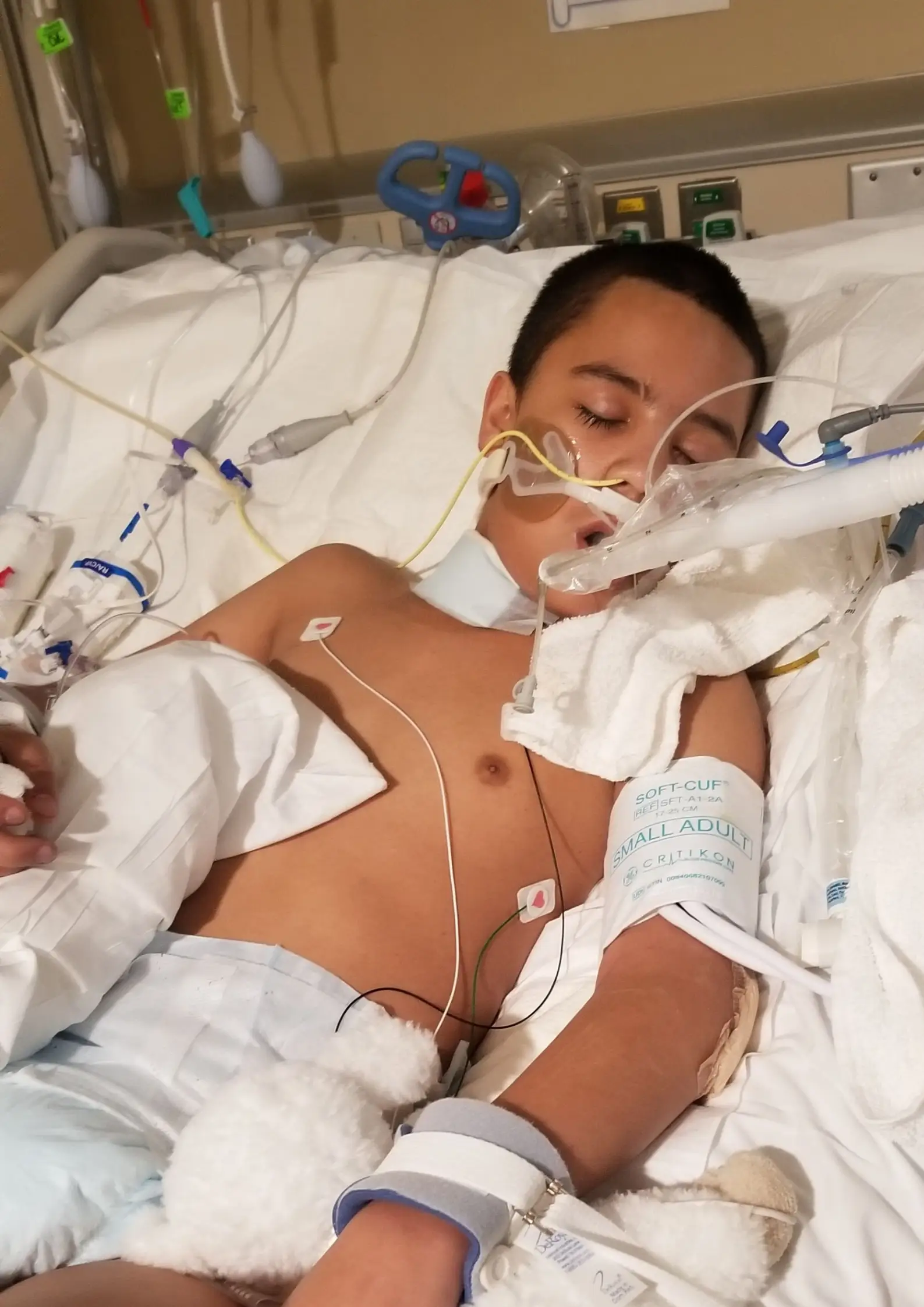 Zach had to go on life support and was put in a coma for two weeks.