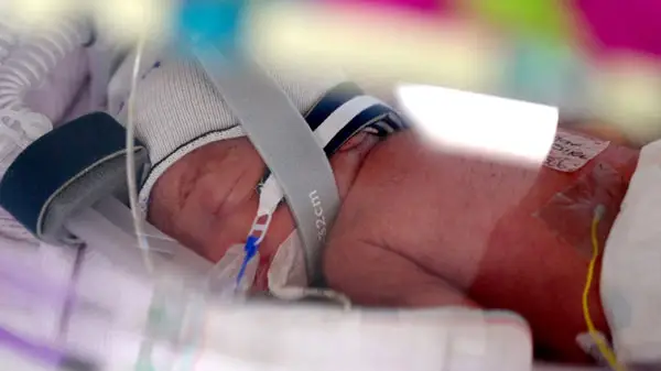 The four babies are all doing 'extremely well', their obstetrician said (Metro North Health)