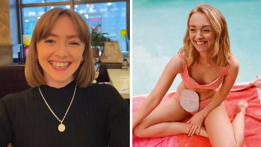 Credit: Instagram/@billieandersonx