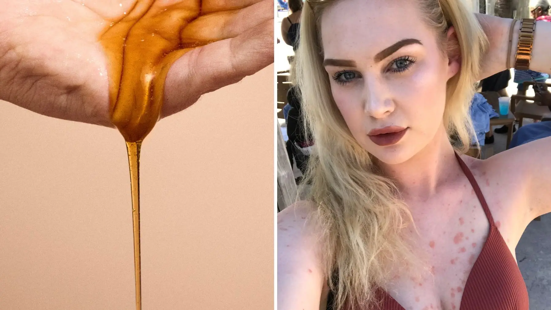 The £12 scalp treatment people swear by for stubborn dandruff when nothing else seems to work