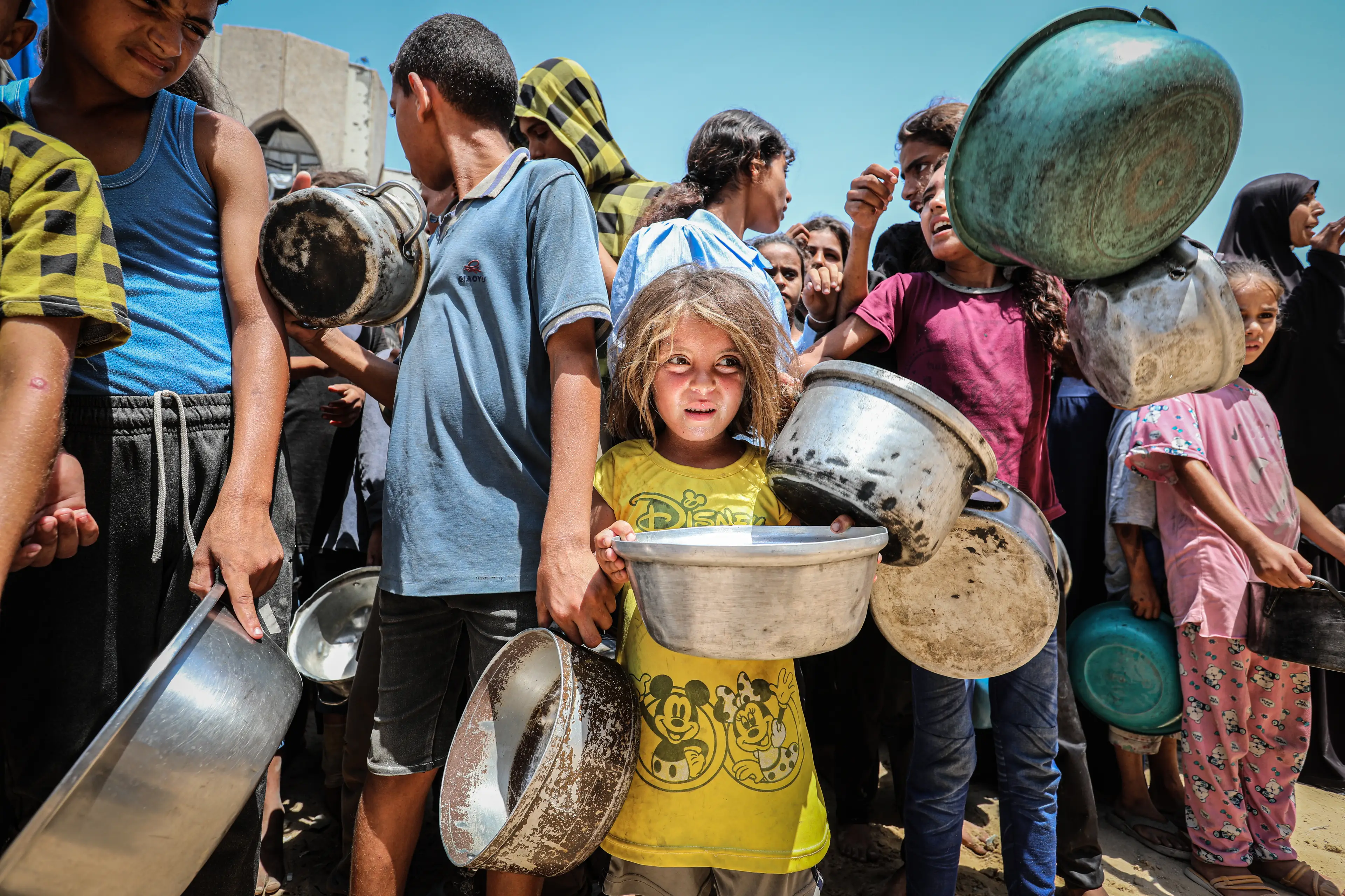 A group between 30 to 50 critically ill and injured Palestinian children will be brought to the United Kingdom in the next 'coming weeks' (Abed Rahim Khatib/Anadolu via Getty Images)