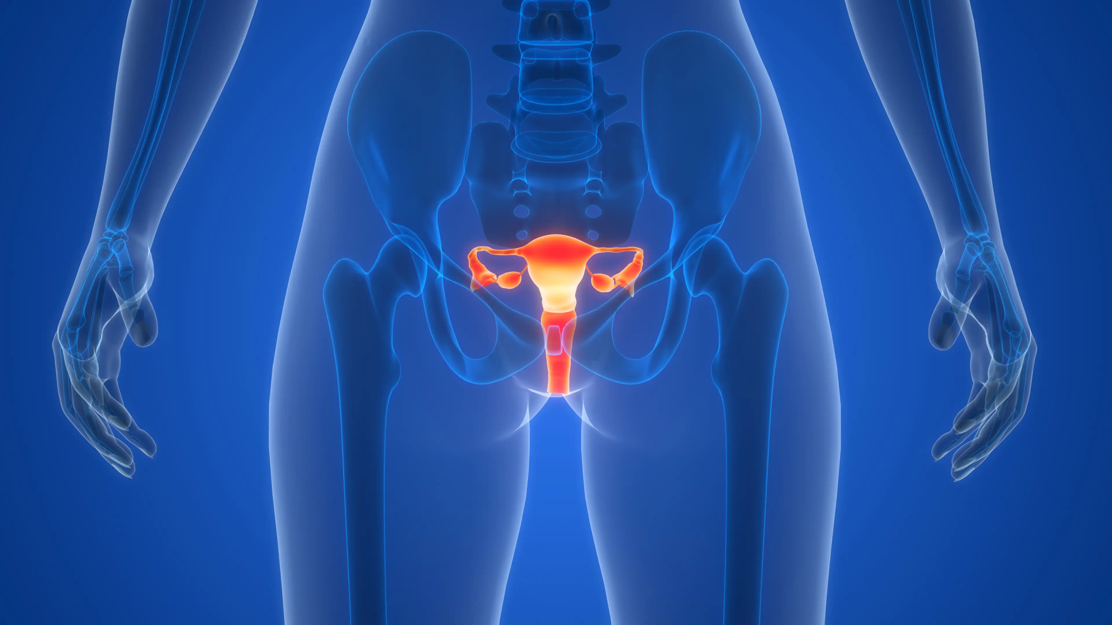 A gynaecologist has explained how to 'reverse' Polycystic Ovary Syndrome (PCOS) (Getty Stock Images)
