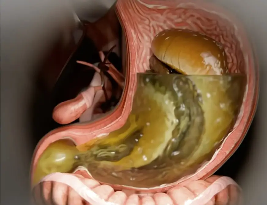 A new video has broken down the process of how Ozempic actually works (YouTube/Zackdfilms)