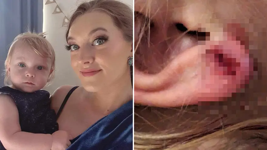 Three-year-old girl rushed to hospital after clip-on earrings ‘take chunks’ out of ear