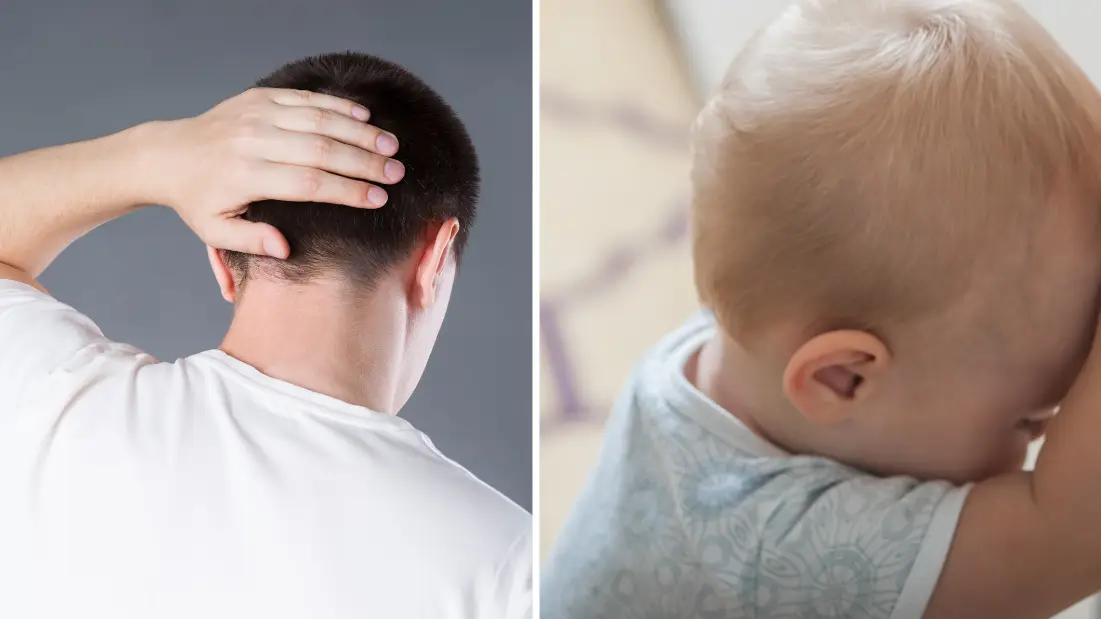Little-known reason why so many people have flat heads at the back