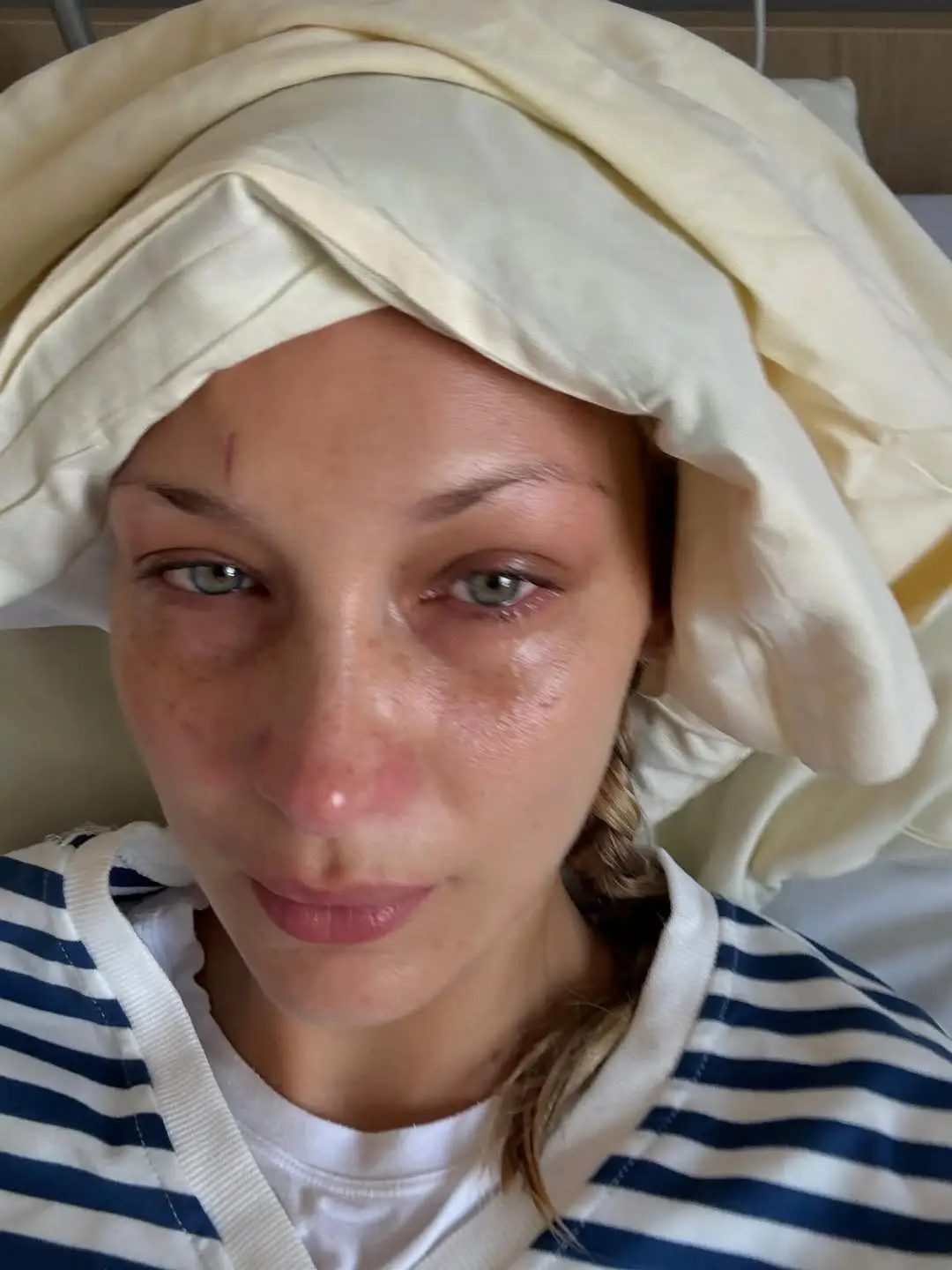 Last week, Bella Hadid and her mother, Yolanda, shared a series of snaps about her Lyme disease treatment in hospital (Instagram/@bellahadid)