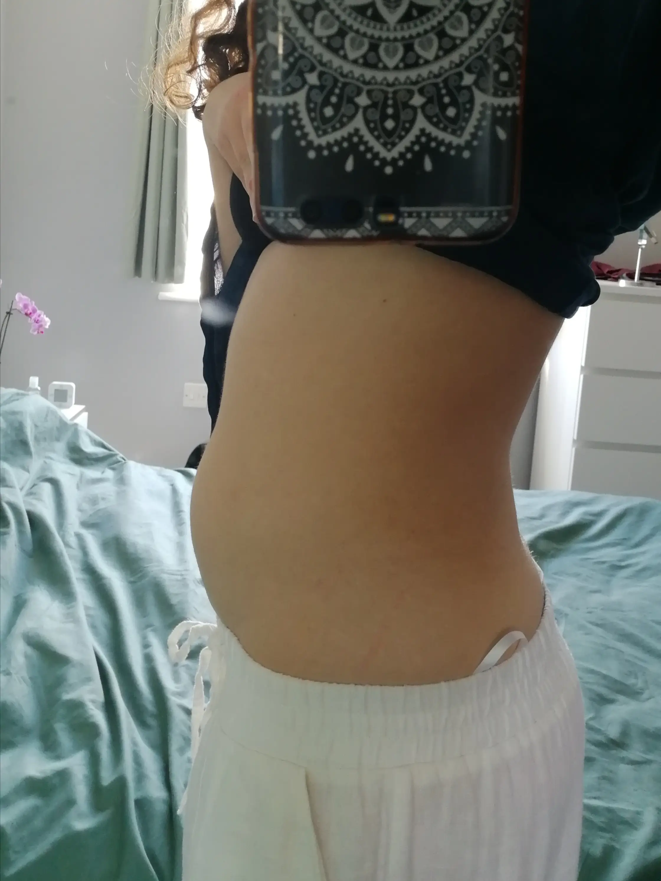 Bloating was one of Chloe's cancer symptoms.