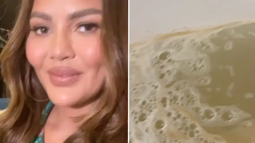 Instagram/@chrissyteigan