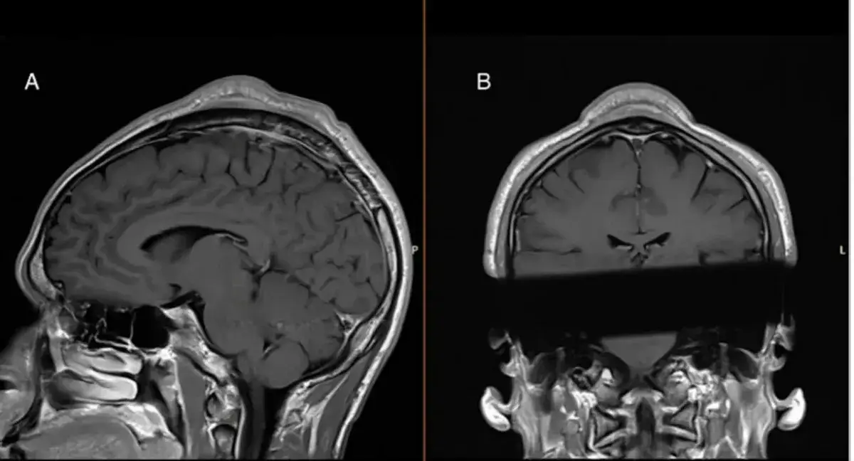 A man sought medical advice after five years (BMJ)