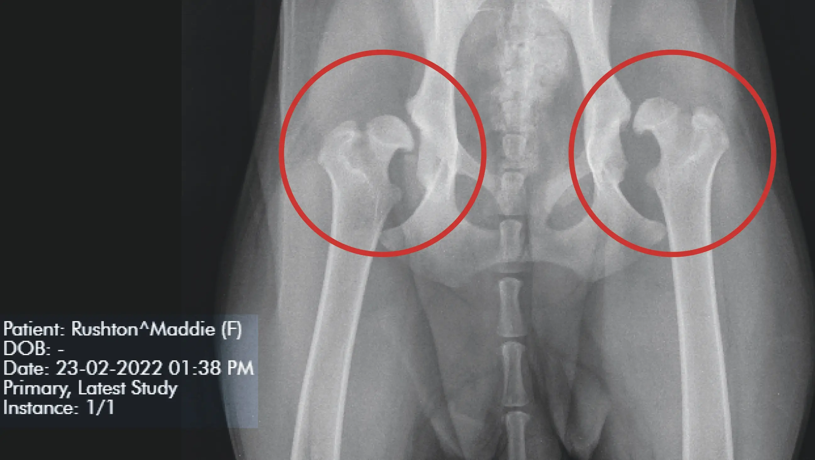 Recue dog Maddie suffers from hip dysplasia.