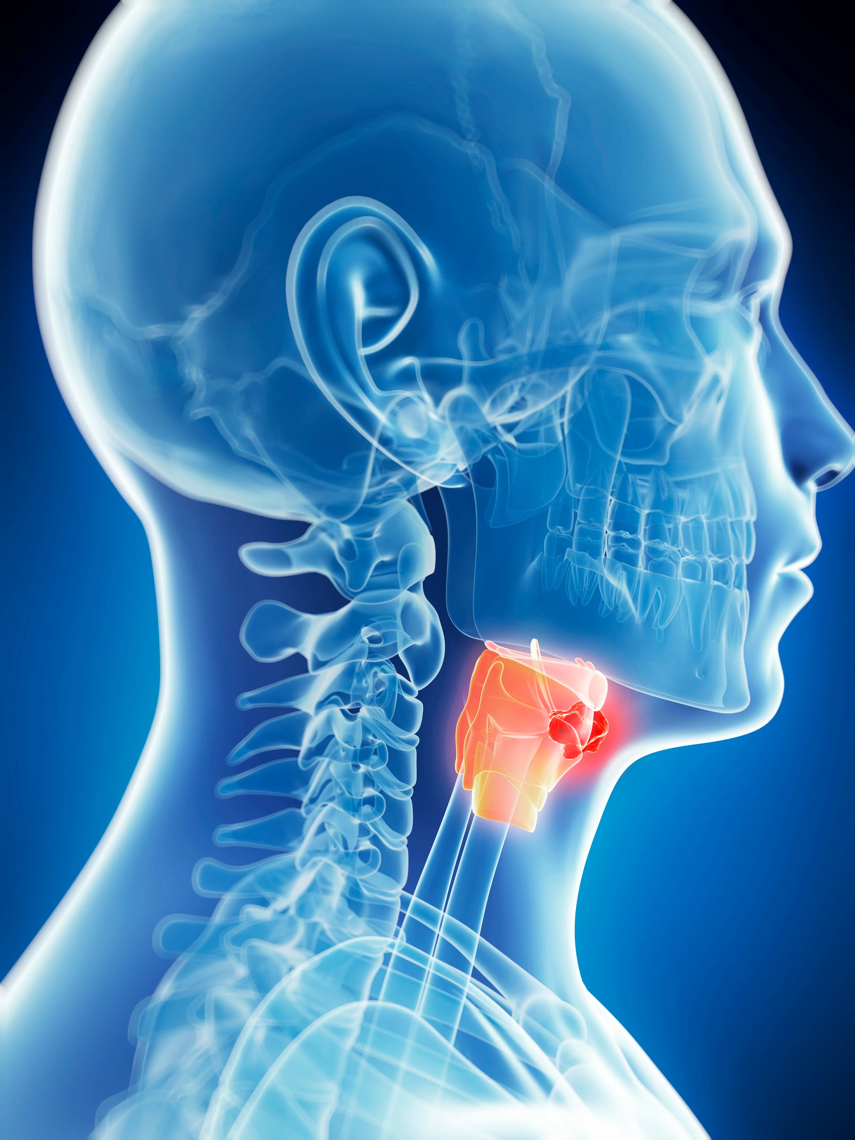 There has been a 'significant' rise in throat cancers among men over the past two decades (Getty Stock Images)