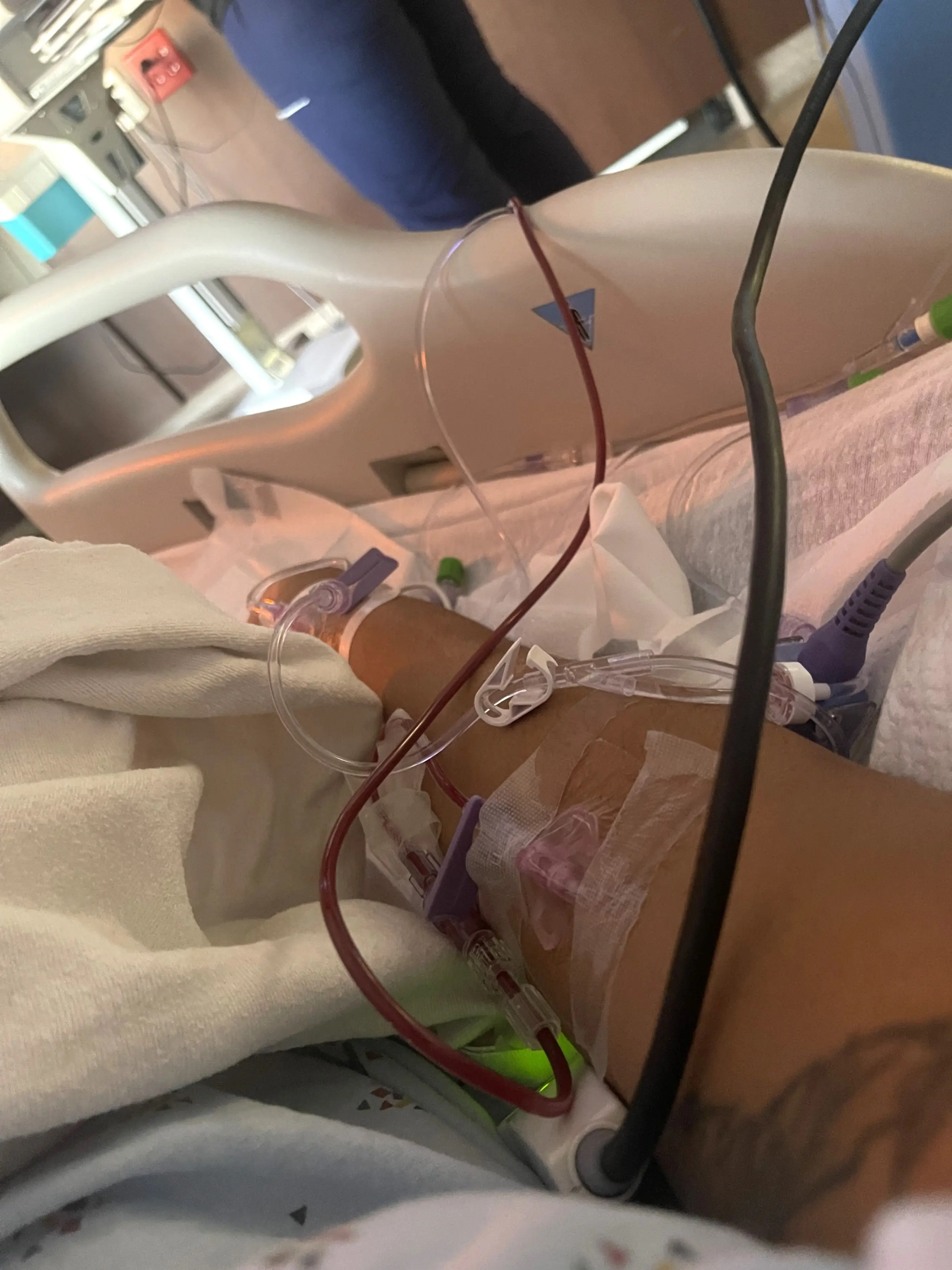 Starla was left fearing she may 'lose' her leg. (Kennedy News & Media)