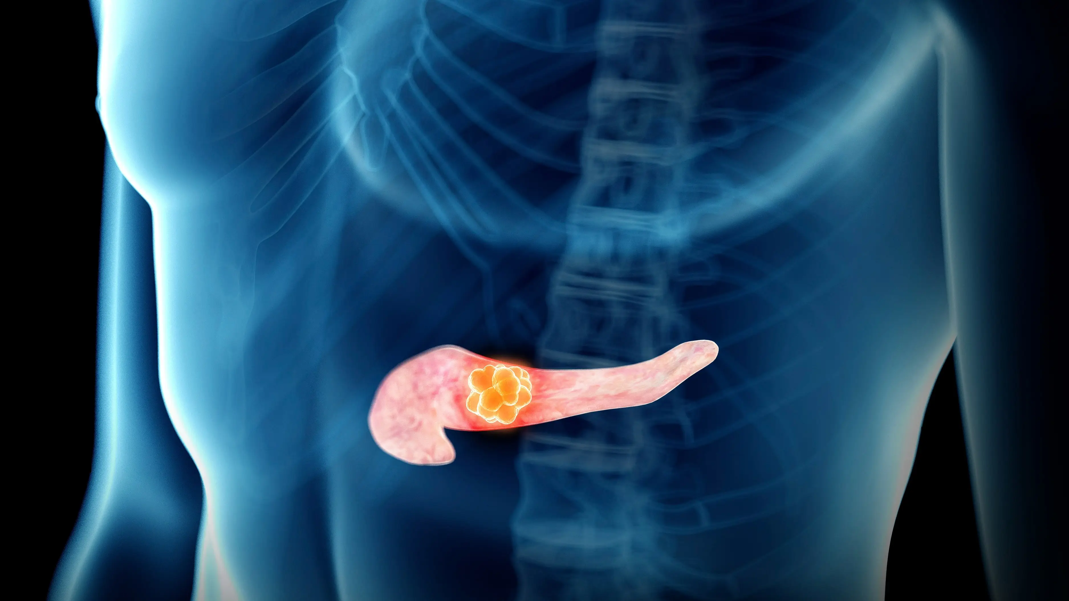 Worrying link between oral health and extremely deadly cancer discovered by scientists