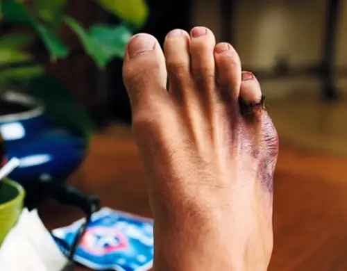 It's since been revealed that a prosthetic toe was used in the scene (HBO)