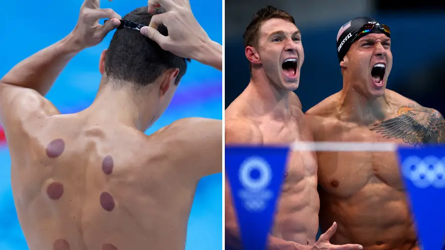 Real reason why some Olympic athletes have dark circles on their backs