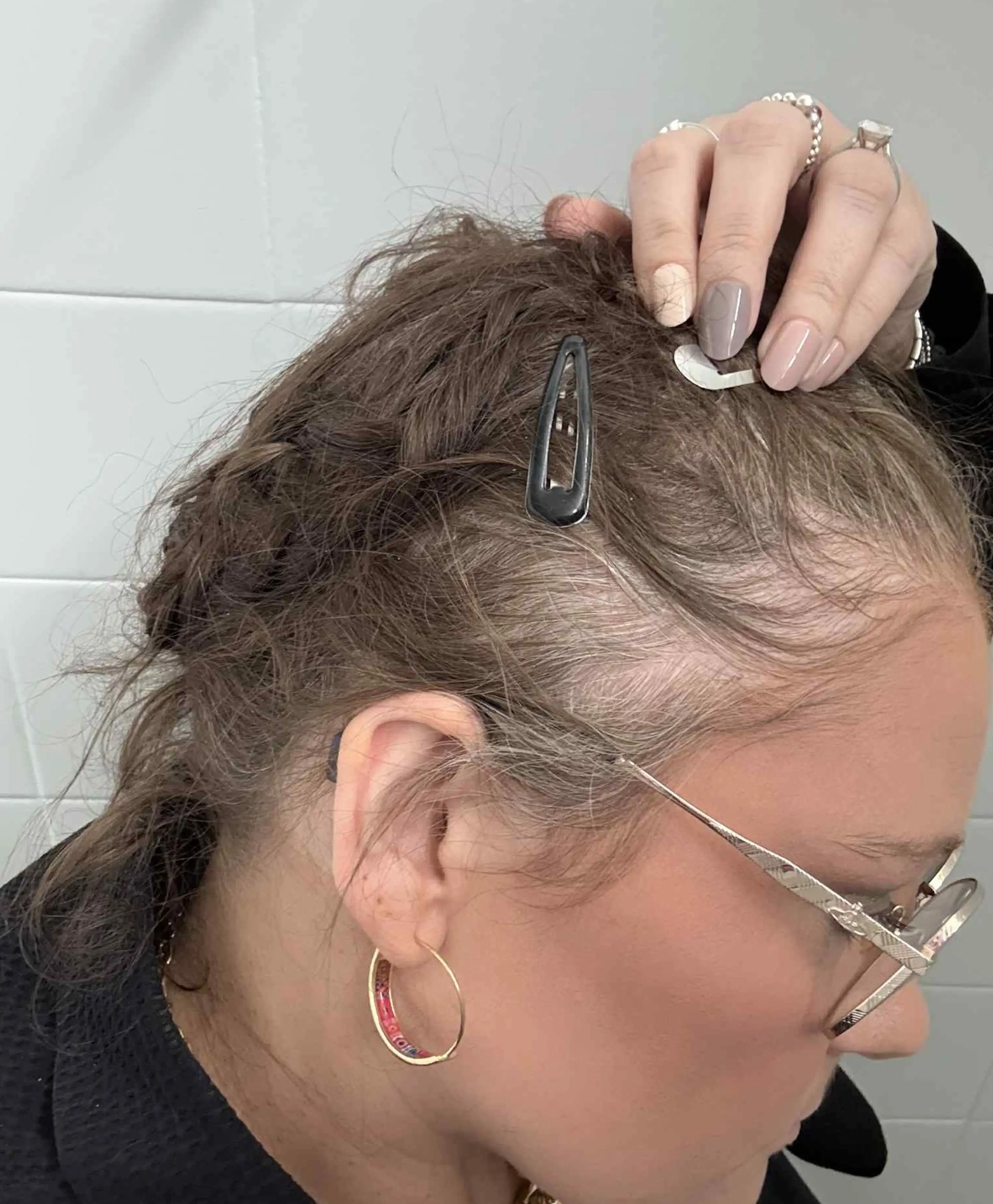 The bride-to-be was shocked by the side effect (Kennedy News and Media)