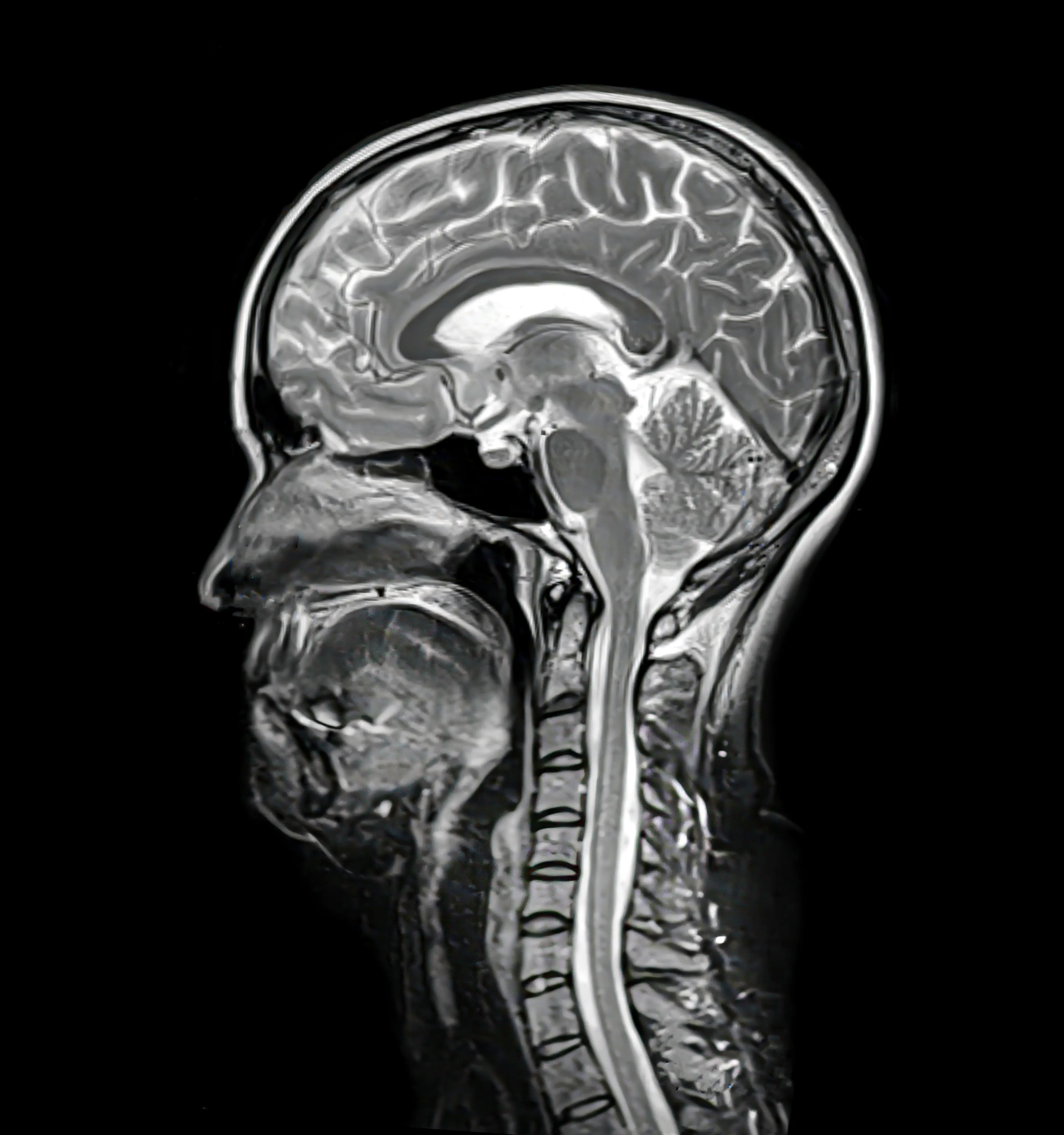 A neurologist has revealed the three supplements that can cause harm if you take too high a dose (Getty Stock Image)