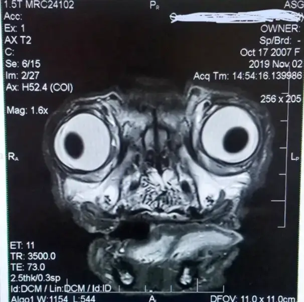 Andy Richter shared the viral photo of the MRI scan (X)