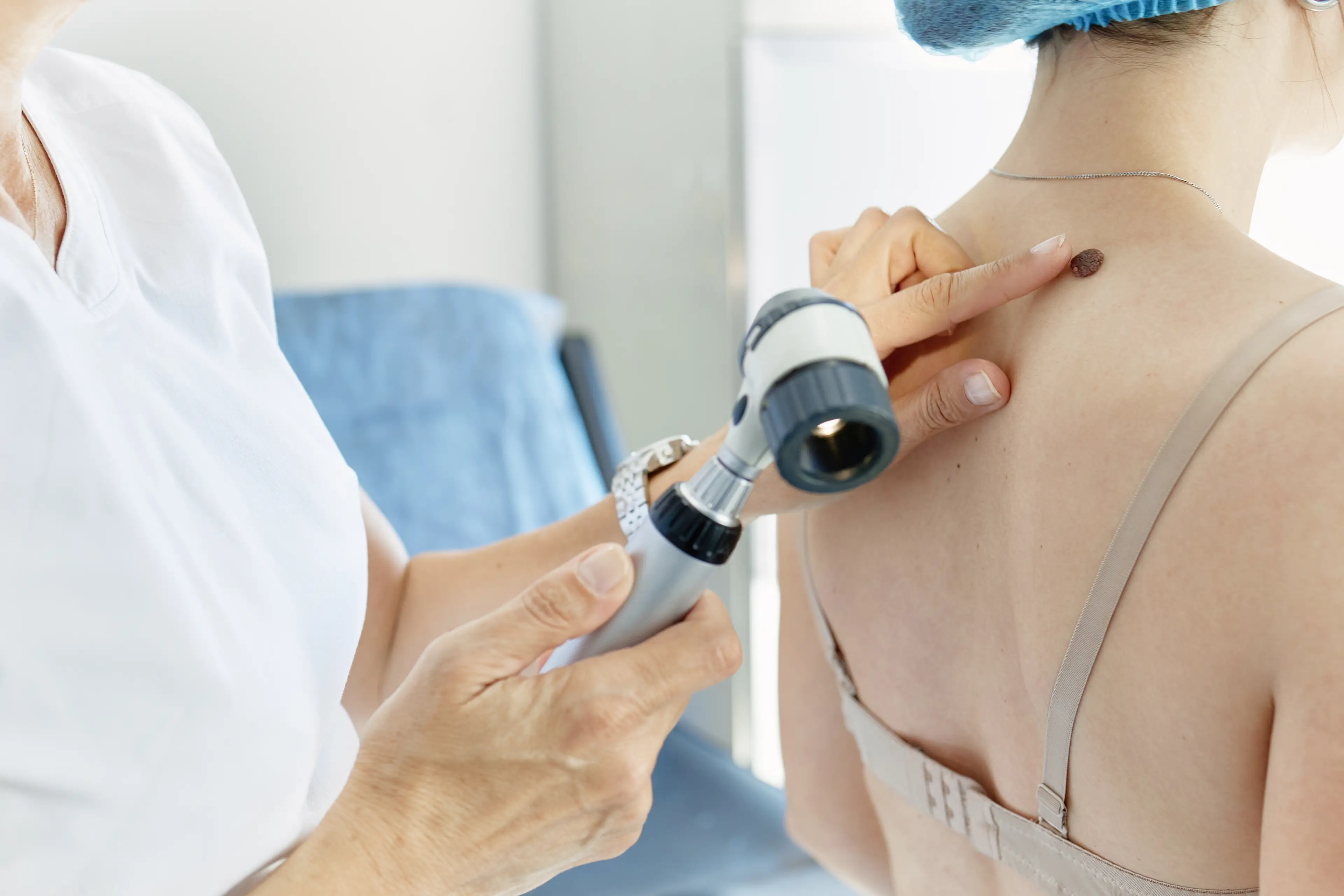 It's important to check for changes on the skin (Getty Stock Image)