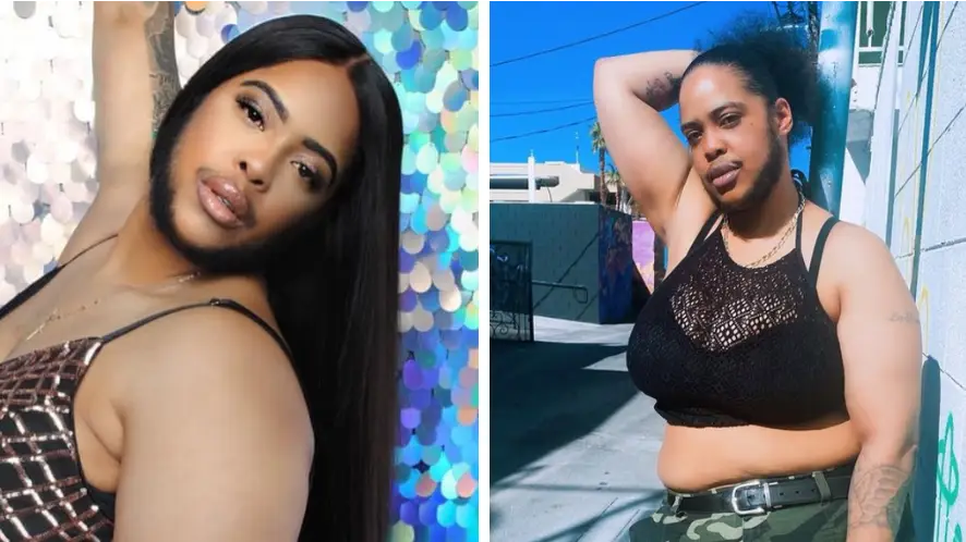 Woman embraces beard she has from battle with hormonal disorder