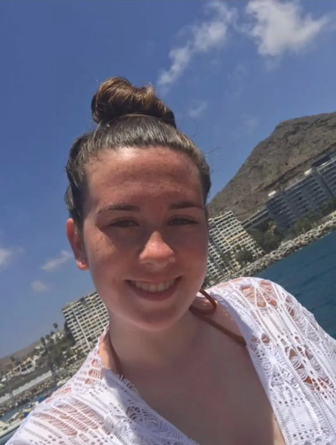 Jordan found a lump behind her ear and experienced extreme fatigue.