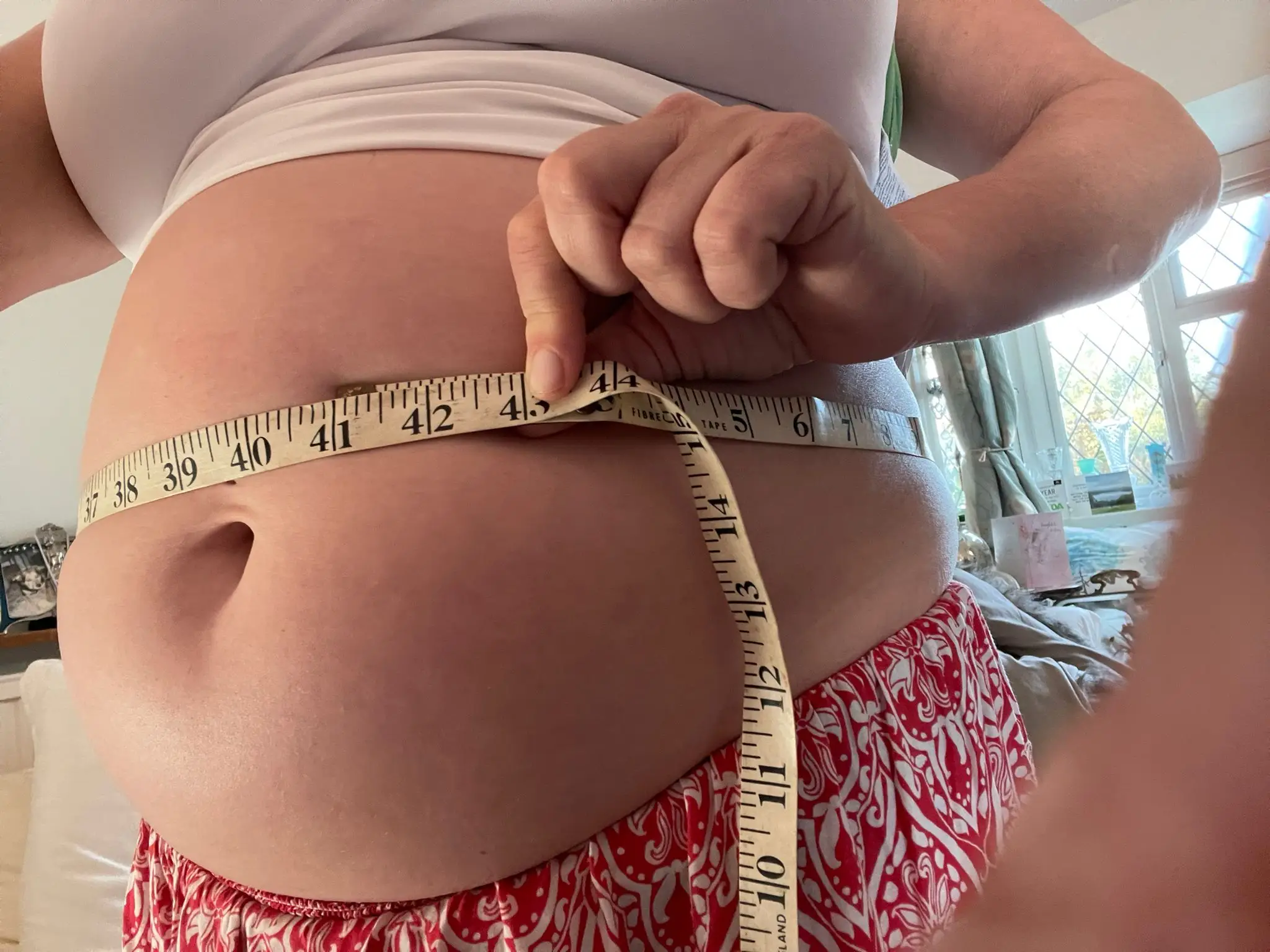 Fibroids left Abigail looking pregnant.