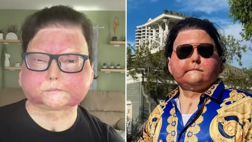 TikTok/@joedimeo/Instagram/@joeroydimeo