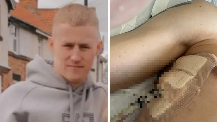 Man, 29, hospitalised with ‘stabbing pains’ in chest found to have serious ‘vaping injury'