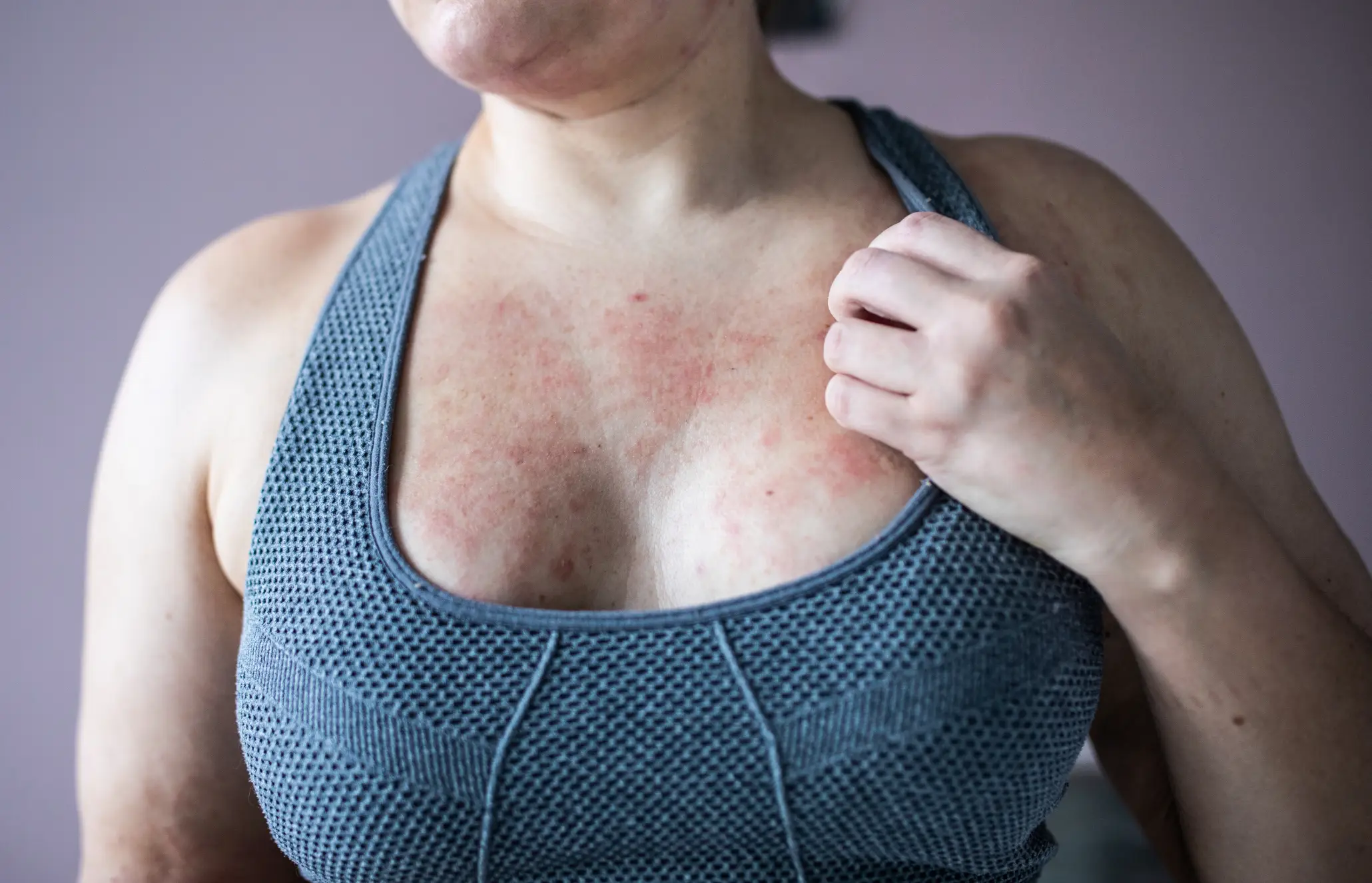 An expert explained why the constant changes in temperature 'catch skin out' (Getty Stock Images)