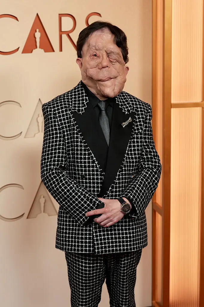 British actor Adam Pearson has responded to a comedian's 'hateful' post about the way he looks (Matei Horvath / Stringer / Getty Images)