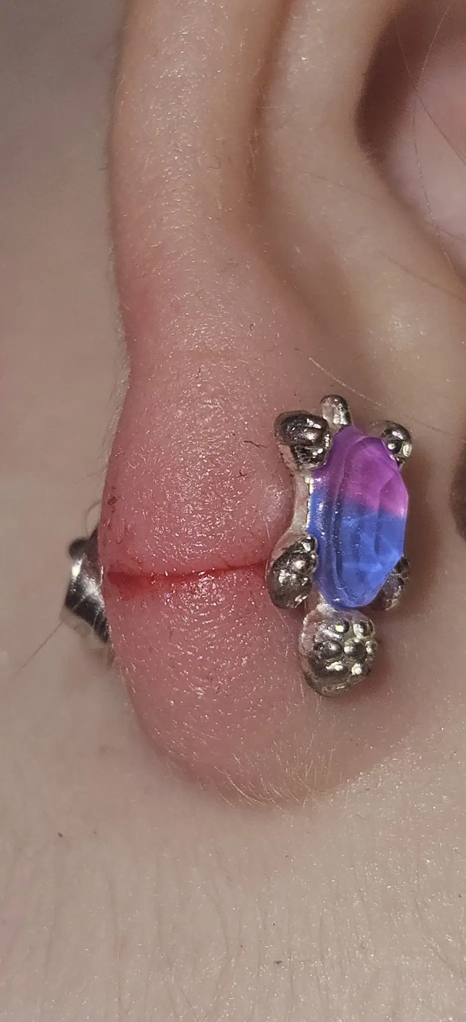 A hair wrapped around the toddler's earring and 'sliced' through her ear.