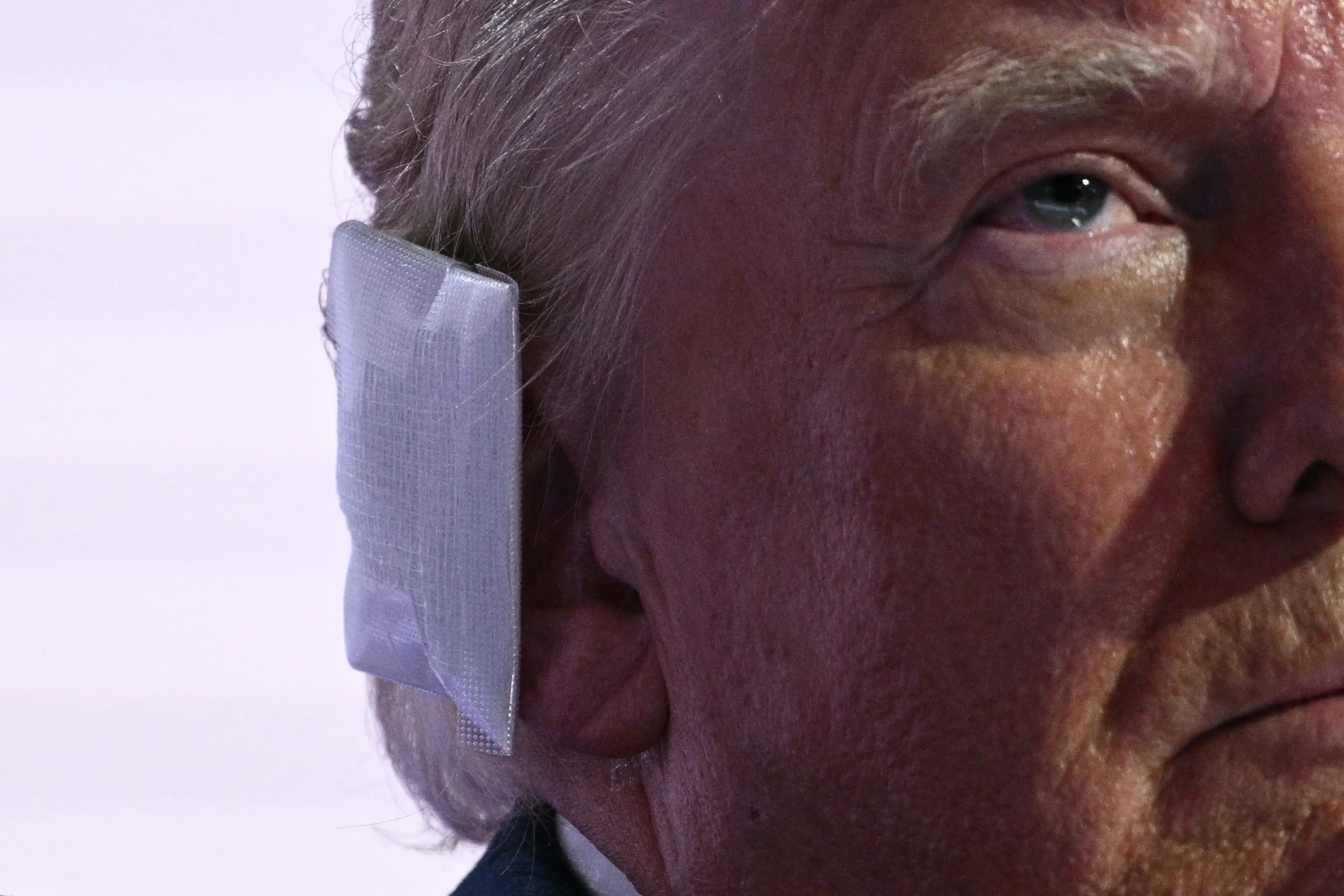 The President claimed he'd been shot in the ear (BRENDAN SMIALOWSKI/AFP via Getty Images)