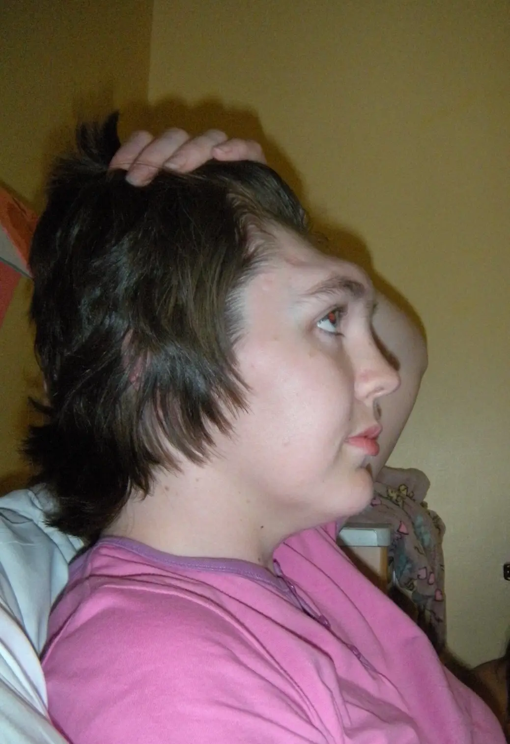 Grainne was left without a forehead.