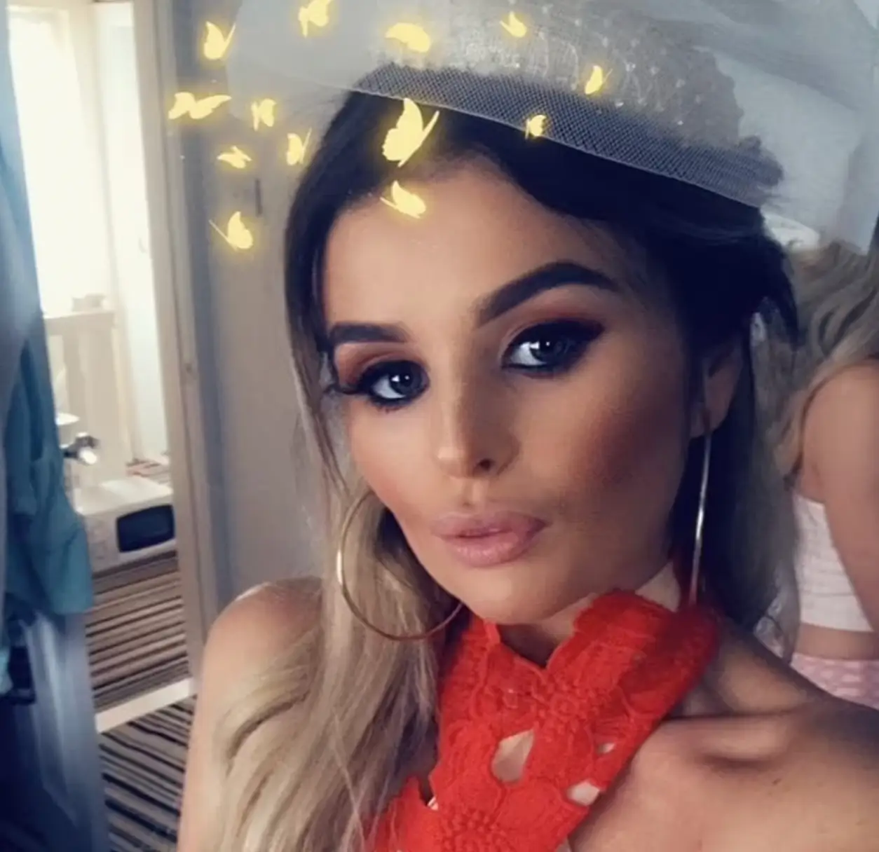 Franchesca has now been told she cannot work as a nurse again for six months. (Franchesca Morgan/Cavendish Press)