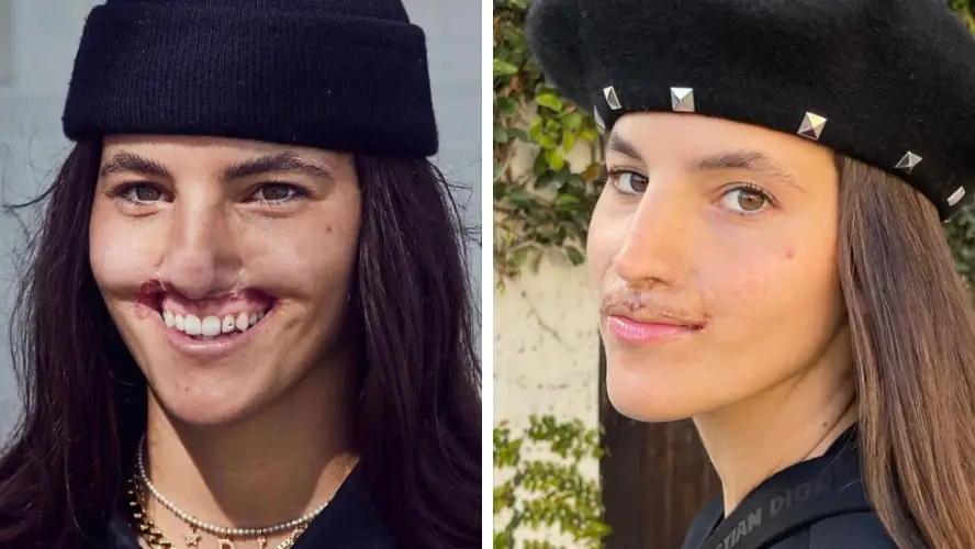 Instagram/brookhoury